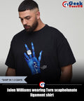 Jalen Williams wearing Torn scapholunate ligament shirt