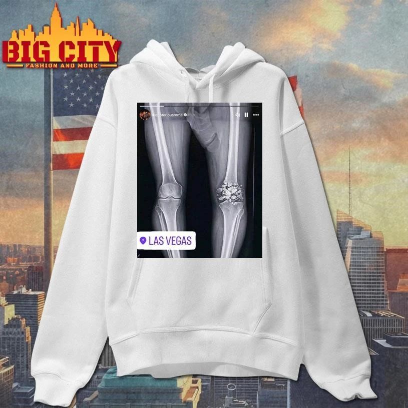 Funny Conor McGregor X-ray Broken Knee knee Shirt