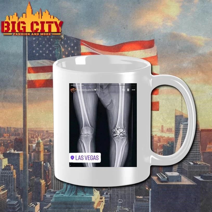 Funny Conor McGregor X-ray Broken Knee knee Shirt