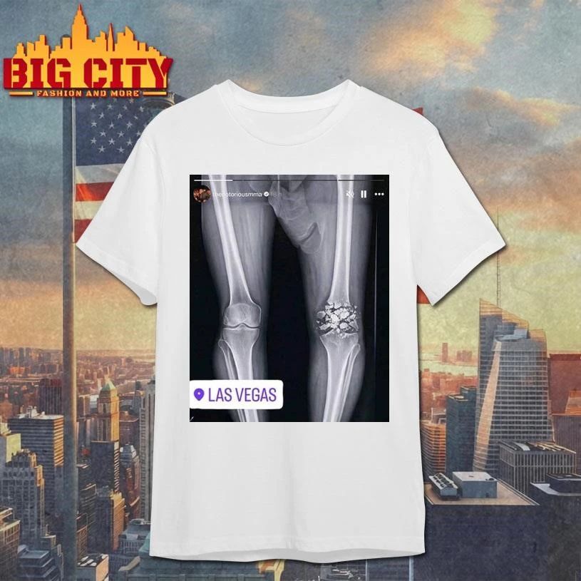 Funny Conor McGregor X-ray Broken Knee knee Shirt