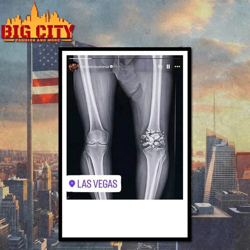 Funny Conor McGregor X-ray Broken Knee knee Shirt